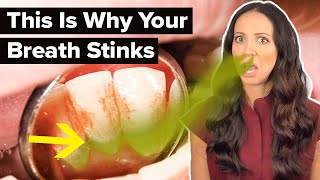 why your breath REALLY stinks dental hygienist explains [upl. by Ivon]