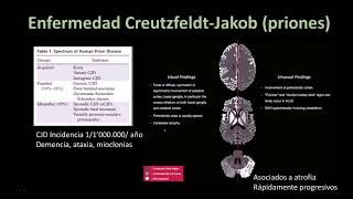 Radiología en 5 minutos Enfermedad Creutzfeldt Jakob Priones [upl. by Akcirederf]