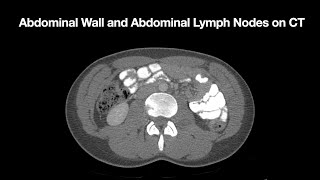 Anatomy of the Abdominal Wall and Abdominal Lymph Node Stations [upl. by Alurta]