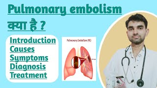 Pulmonary embolism in Hindi  Causes  Sign and Symptoms  Treatment of Pulmonary Embolism [upl. by Lielos]