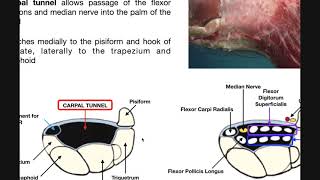 Anatomy amp Structures in the Carpal Tunnel [upl. by Robertson]