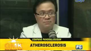 What is Atherosclerosis [upl. by Winston]