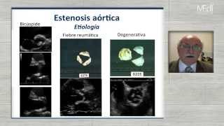 My Echo Cardio Lab Clase 5 estenosis aortica [upl. by Diantha]