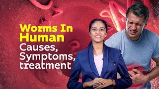 Worms In Human  Causes Symptoms treatment  Healthy Life Style  Worm Diseases [upl. by Melak]