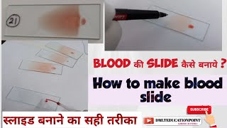 blood की slide कैसे बनाये slide kaise bnaye  HematologyMaking a paripheral Blood smear slide [upl. by Akiemahs524]