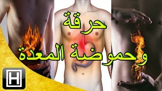 علاج حرقة المعدة والحموضة طبيعيا وبأفضل وأسهل الوصفات [upl. by Gery633]