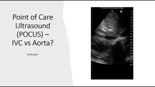 Point of Care Ultrasound POCUS  How to Differentiate IVC vs Aorta [upl. by Cece]