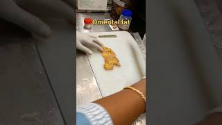 Omental fat tissue for histopathology processing [upl. by Flodur133]