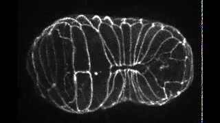 Epidermal morphogenesis of C elegans 線虫の表皮形態形成 [upl. by Inerney298]