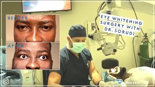 Does Insurance Cover LASIK [upl. by Geminian110]