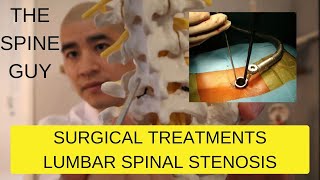 Part 3  Surgical Treatments for Lumbar Spinal Stenosis [upl. by Adnilec]