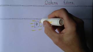 Edema exudates or transudates [upl. by Tucker]