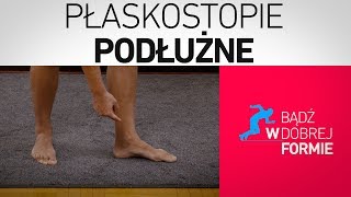 Płaskostopie podłużne  KINESIOTAPING [upl. by Nevs]