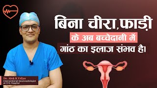 Uterine Fibroid Embolization UFE In Hindi  Uterine fibroid in hindi  Dr Alok K Udiya [upl. by Brant]