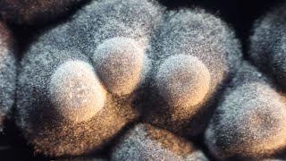 Streptomyces bacteria that look like moulds [upl. by Sueaddaht]