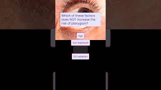 Pterygium vs Ocular Surface Cancer Quiz [upl. by Samuelson]