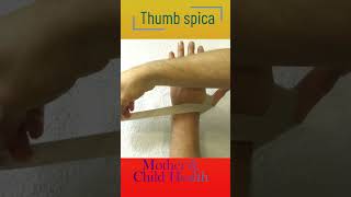 Thumb spica [upl. by Ahsikam]