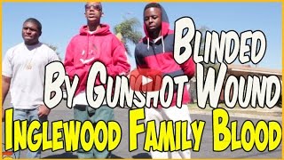 Munchie B from Inglewood Family Bloods lost vision after getting shot in head pt1of2 [upl. by Legyn]