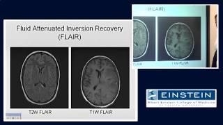 Introducing MRI Inversion Recovery 35 of 56 [upl. by Jenelle856]