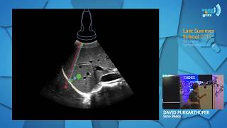 Sono Basics  Grundlagen der fokussierten Sonographie  David Purkarthofer  Late Summer School 2019 [upl. by Ahsiema]