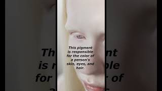 fact about albino people [upl. by Adok66]