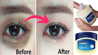 Remove Dark Circles in 3 days with Vaseline Permanently  Dark circles under eyes home remedy [upl. by Viddah703]