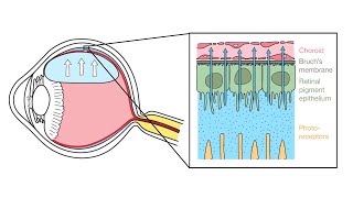 Mechanism of Retinal Reattachment Following Pneumatic Retinopexy [upl. by Morley]