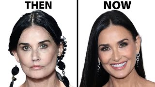 Demi Moores NEW FACE  Plastic Surgery Analysis [upl. by Blackington]