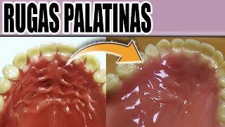 HACER RUGAS PALATINAS EN PRÓTESIS DENTAL PASO A PASO [upl. by Neetsirhc]