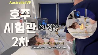 시험관 2차 호주IVF  채취  이식  먹부림  강아지랑 시드니 여행 [upl. by Alrahs]