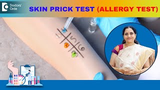 Allergy Skin Tests  SKIN PRICK TEST  How is it performed  DrP Lakshmi Satish  Doctors Circle [upl. by Cornelie]