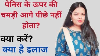 PHIMOSIS  पेशाब की नली पूरी तरह नहीं खुलना urinary urinaryinfection urinarytractinfection [upl. by Alaine260]