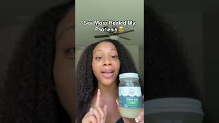 Sea Moss For Psoriasis [upl. by Tteltrab]