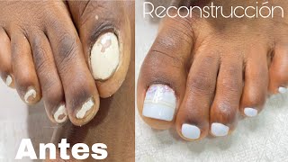 Reconstruccion de uñas de pies con polygel acripie desde el principio [upl. by Assirahs437]