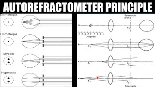 Autorefractometer Principle  AK Khurana  Dr Saud Javed [upl. by Lilith]