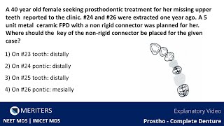 NEET MDS  INICET  Prostho  Fixed Partial Denture  Explanatory Video  MERITERS [upl. by Frederick]