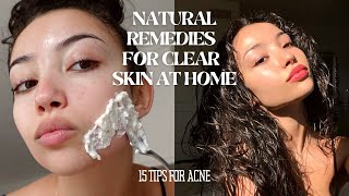 HOW TO MAINTAIN CLEAR SKIN WITHOUT SPENDING MONEY  15 tips and tricks for acne [upl. by Nomar219]