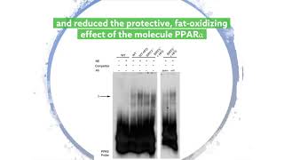 Enzyme deficiency worsens fatty liver disease [upl. by Yenetruoc]