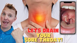 Drain Your Sore Throat Away Right Now sorethroat tutorial [upl. by Kohn545]