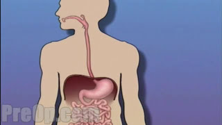 Esophagogastroduodenoscopy [upl. by Nishi]