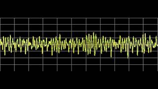 Meningitis  Rife Frequencies [upl. by Berman706]