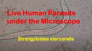 Human Parasites Live under the Microscope  Strongyloides stercoralis [upl. by Albertson812]