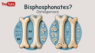 【Bisphosphonates】Pharmacology  Mechanism of Action Simply Explained [upl. by Retsek]