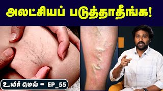 Vericose Vein ரொம்ப நேரம் நிப்பீங்களா  Positionஅ இப்டி மாத்துங்க  Uyirmei EP55 [upl. by Bore]