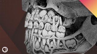 Where Do Teeth Come From [upl. by Corneille]