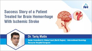 Patient Success Story  Brain Hemorrhage with Ischemic Stroke  Dr Tariq Matin [upl. by Durrej]