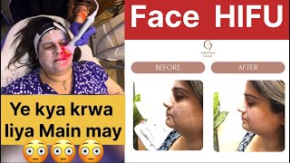 Face HIFU Treatment krwya  Shadi pay jane ke Taiyari end hoi  Sweejackvlogs [upl. by Lamag]