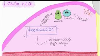 Patogénesis de la enfermedad periodontal [upl. by Vivia307]