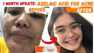 SKINOREN CREAM REVIEW  AZELAIC ACID [upl. by Joellen]