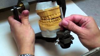 Occlusion Laboratory Video Guides Video 4 Setting Up Articulator for Waxing [upl. by Gamali]